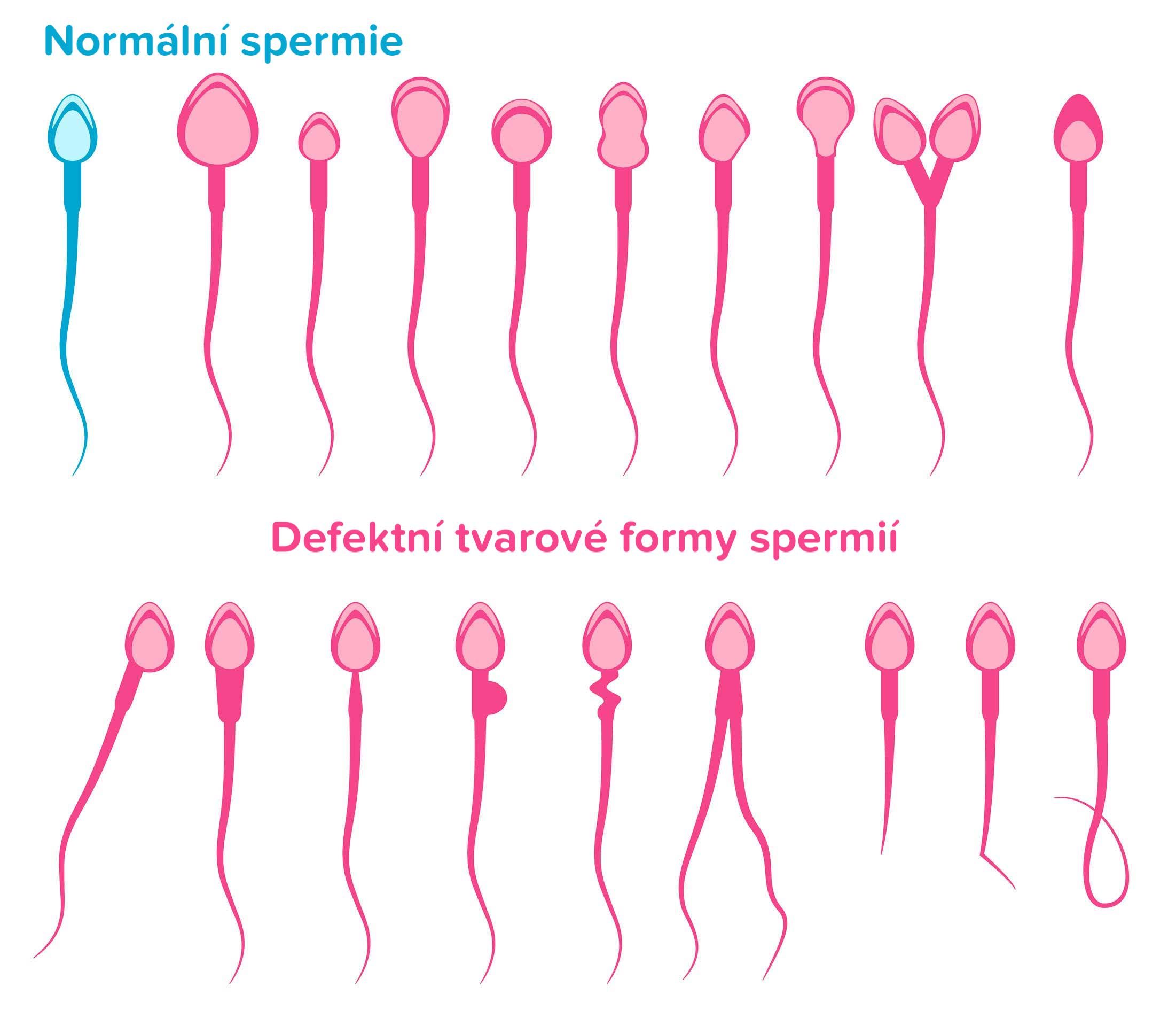 Morfologie spermií